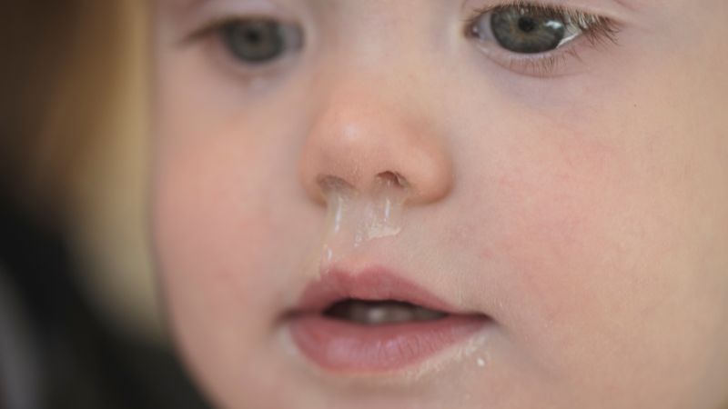 Những giải pháp cho trẻ bị sổ mũi khò khè