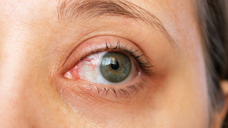 Người dùng máy tính hay bị khô mắt vì sao? 5 lý do và cách khắc phục hiệu quả